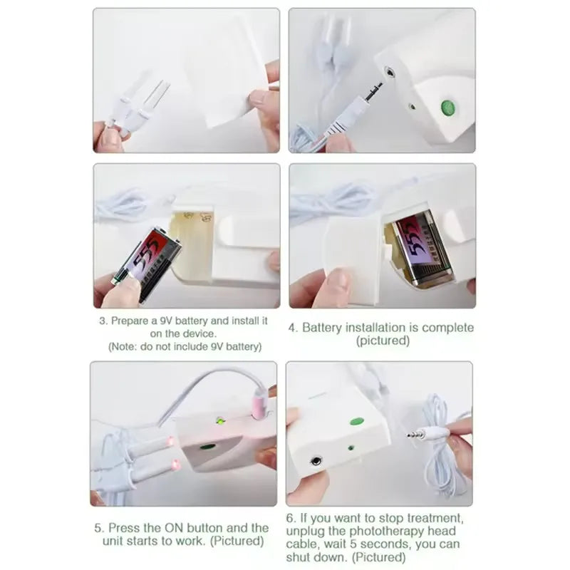 BioNase Laser Therapy Nose Massager — Rhinitis & Hay Fever Relief Device