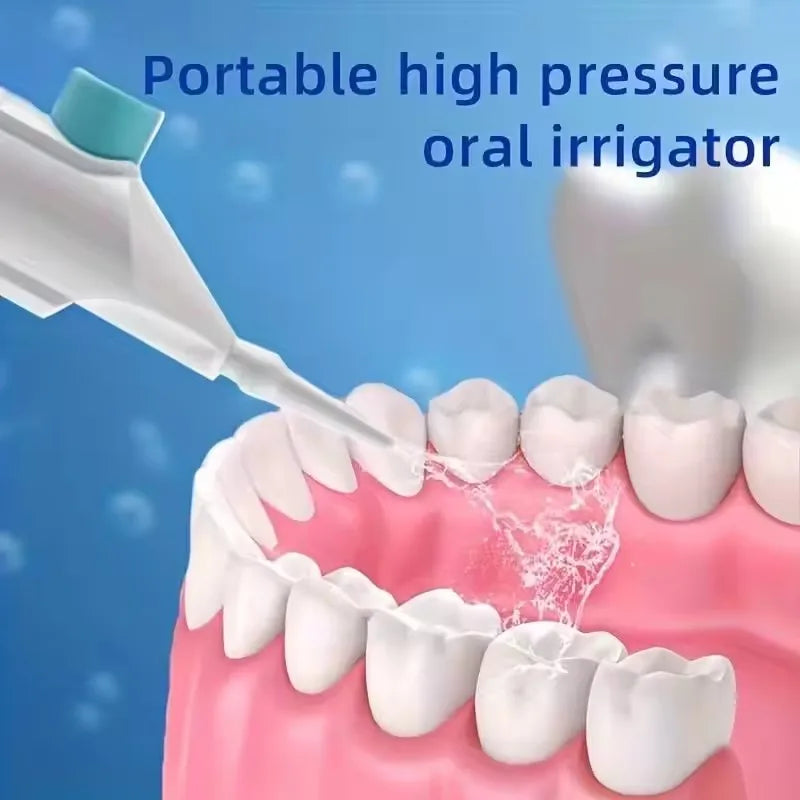 Portable High-Pressure Oral Irrigator — Manual Water Flosser for Teeth Cleaning